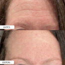 Silicone Lavável para Rugas do Rosto Adesivo Muy Bela Colágeno Natural Anti Marcas Reduz Rugas Skin Care Reutilizável