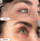 Silicone Lavável para Rugas do Rosto Adesivo Muy Bela Colágeno Natural Anti Marcas Reduz Rugas Skin Care Reutilizável