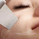 Aparelho Peeling Ultrassônico | Limpeza Facial Profunda + Remoção de Cravos